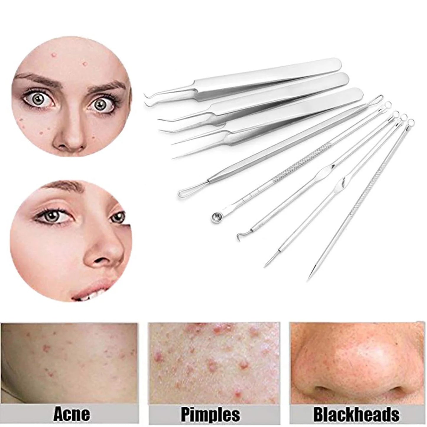 Blackhead Removers Comedone Pimple Popper Tool Acne Extractors Blemish Remover Ingrown Hair Tweezers Removal Kit Whitehead Remover Zit Treatment Skincare Tools for Face Nose, 8-in-1