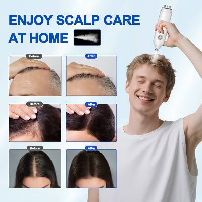 Morfone 3-in-1 Hair Care Oil Sprayer with Red Light Therapy and Nano-Mist Spray Head, Electric Scalp Massager for Hair Growth Promotion, Unisex