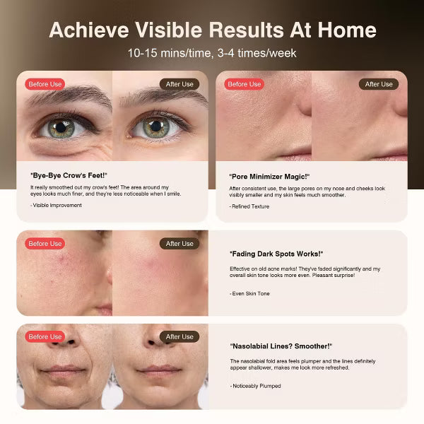 Morfone 9 Mode Facial Red Light Therapy 850nm Infrared and Red Light Mask Home Light Therapy Skincare