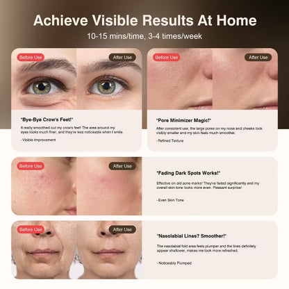 Morfone 9 Mode Facial Red Light Therapy 850nm Infrared and Red Light Mask Home Light Therapy Skincare