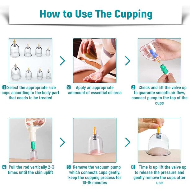 iFanze Cupping Set, 32 Pcs Cupping Kit, Professional Chinese Cupping Therapy, Cupping Therapy Sets with Vacuum Pump, Cups for Massage, Back Pain Relief & Cellulite Reduction