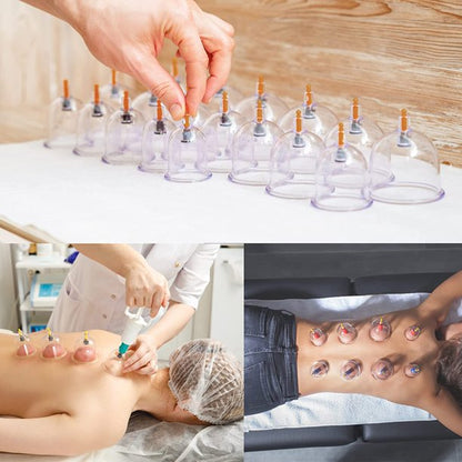 iFanze Cupping Set, 32 Pcs Cupping Kit, Professional Chinese Cupping Therapy, Cupping Therapy Sets with Vacuum Pump, Cups for Massage, Back Pain Relief & Cellulite Reduction
