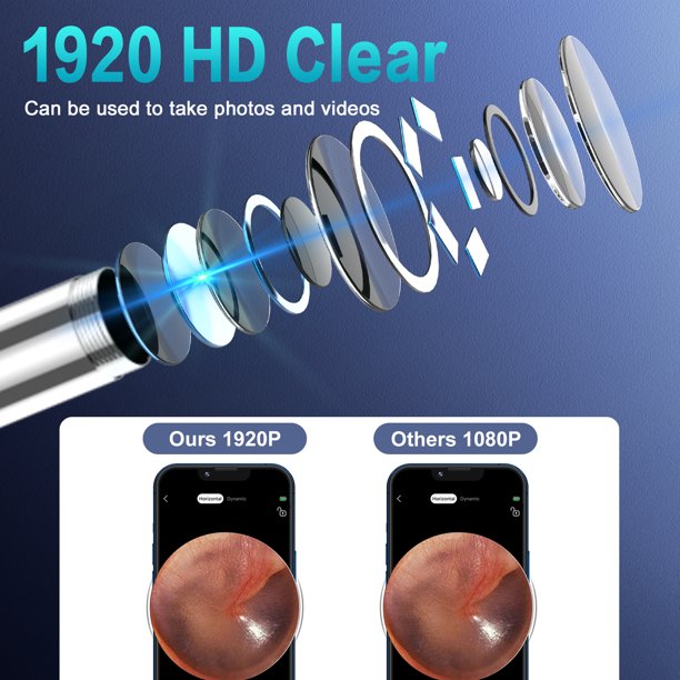 VITCOCO Ear Wax Removal Kit 1920P HD Ear Wax Camera Cleaner 3mm Visual Wireless Otoscope with 6 LED Lights Portable USB Charging Ear Remover Cleaning Kit for iPhone, Android and Ipad?Black?
